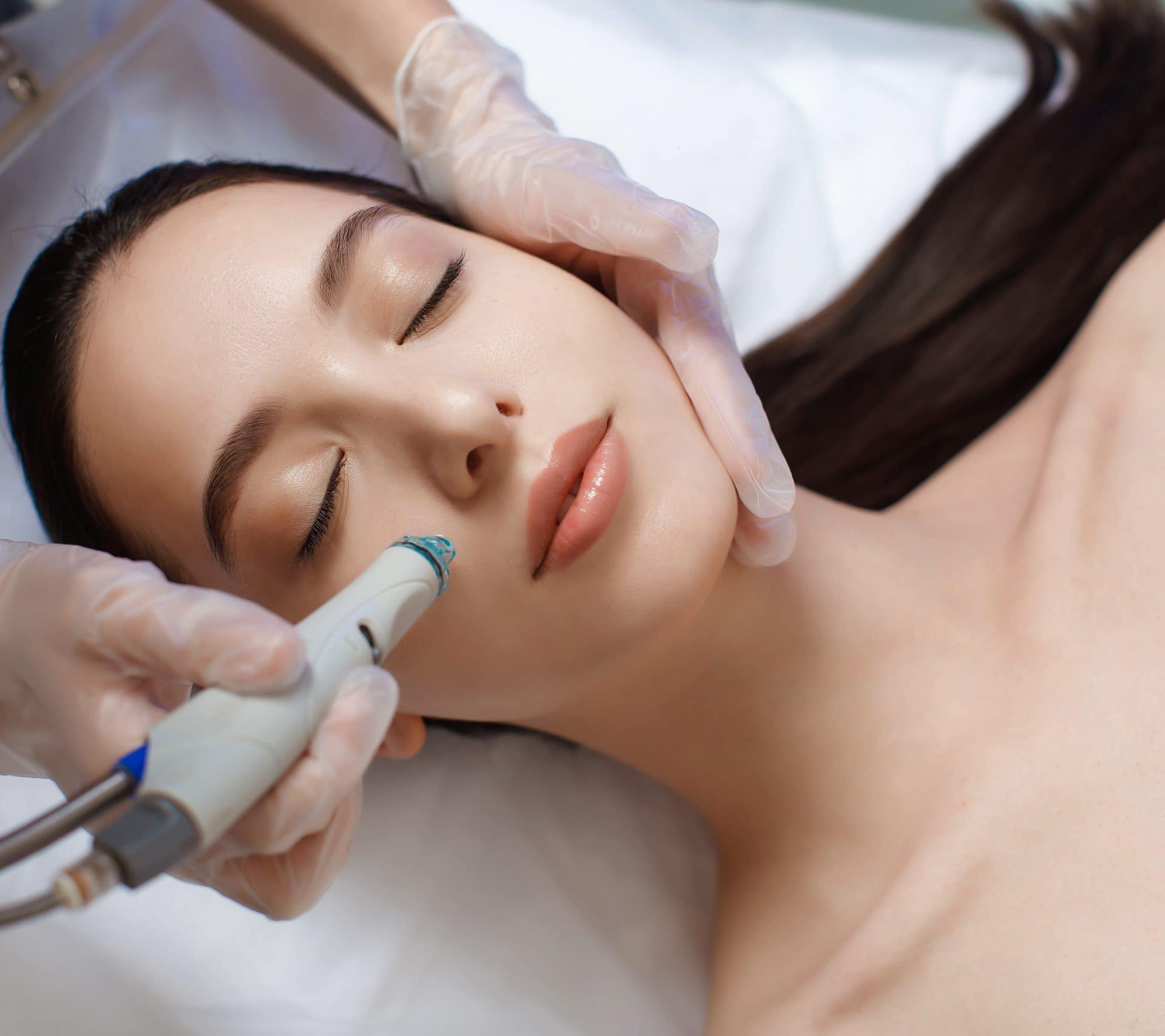 Microneedling Procedure Surfside